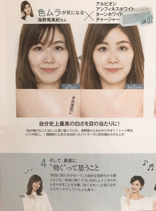 今からでも遅くない!アラサーから始める美白ケア♡_4