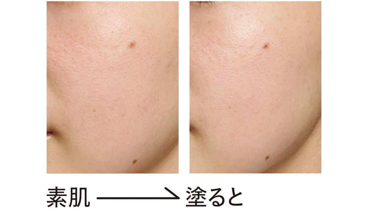 ORBISのビフォーアフター画像