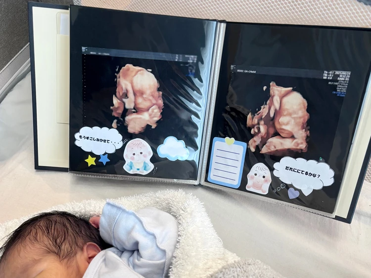 ［愛育病院］無痛分娩レポ｜2024＆2025の2回出産実体験_2