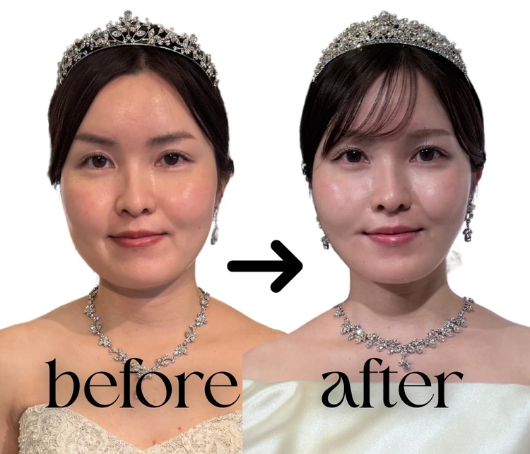 【無加工】3ヶ月で劇的垢抜け!プレ花嫁がやった5つのこと_4