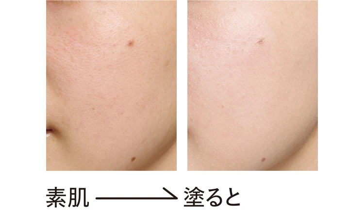 ETVOSのビフォーアフター画像