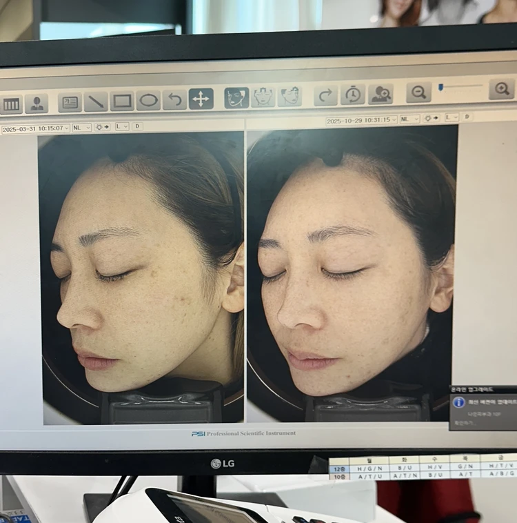 韓国旅行で覚えておくといい韓国語｜皮膚科編_1_1