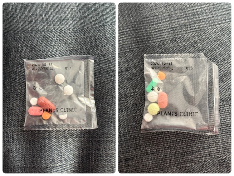 【韓国美容レポ】二の腕撲滅大作戦!ソウルのプランエスクリニックで話題のペッ注射に挑戦!当日の流れとリアルな効果は?_11