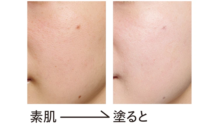 Eléganceのビフォーアフター画像