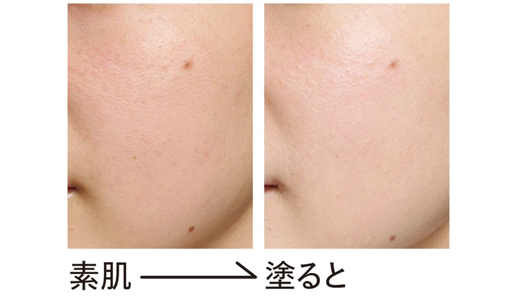 SKIN AQUAのビフォーアフター画像