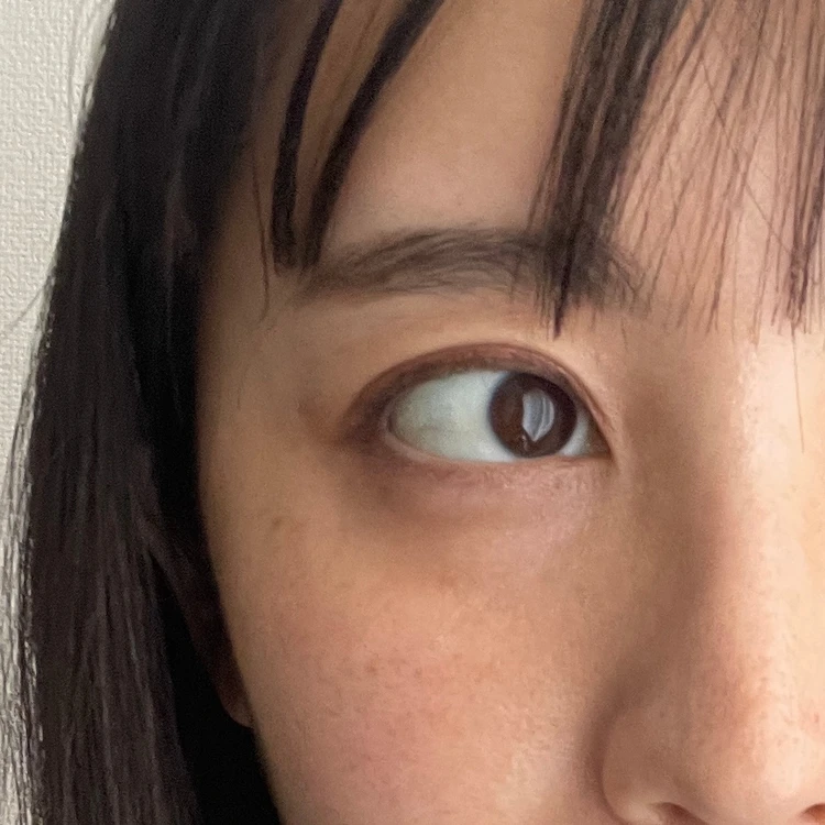 点眼後の改善された瞳