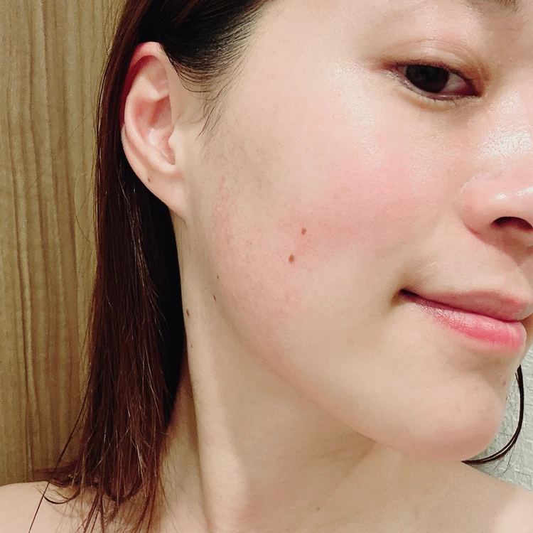 【365日フェイスパックを使う私のイチオシ!】VTCOSMETICSのリードルS トーンオン デイリーマスク_5_2