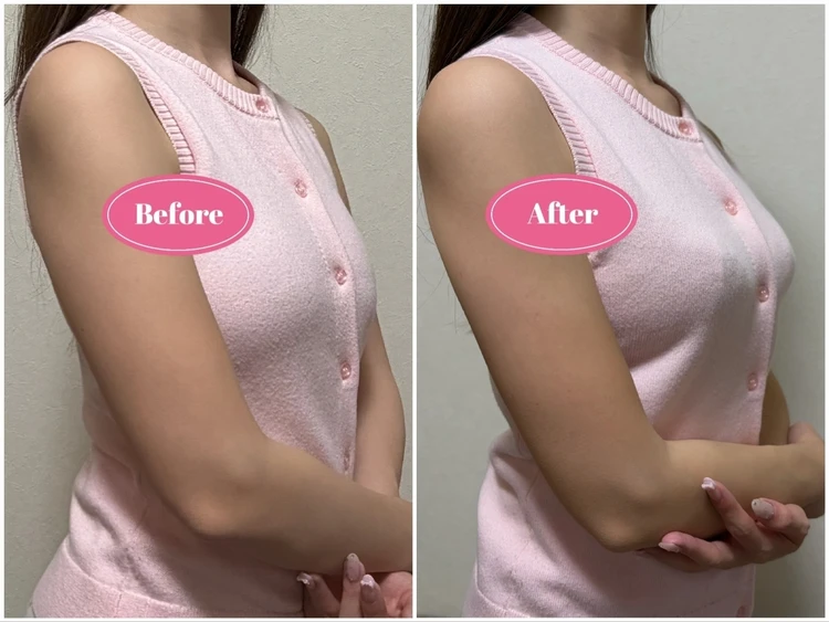 産後の体型変化に終止符！【ブラデリスニューヨーク】で出会った運命の1着_6