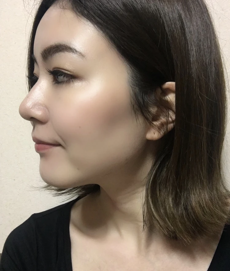 2週間でほうれい線が消えた!噂の美顔器セリキュア4t プラス_6