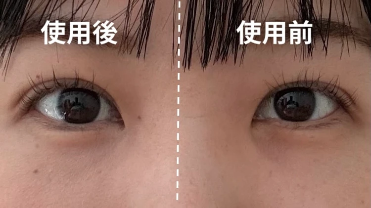 LUNA コンシーラーを使用してクマ消しをしたビフォーアフターの写真