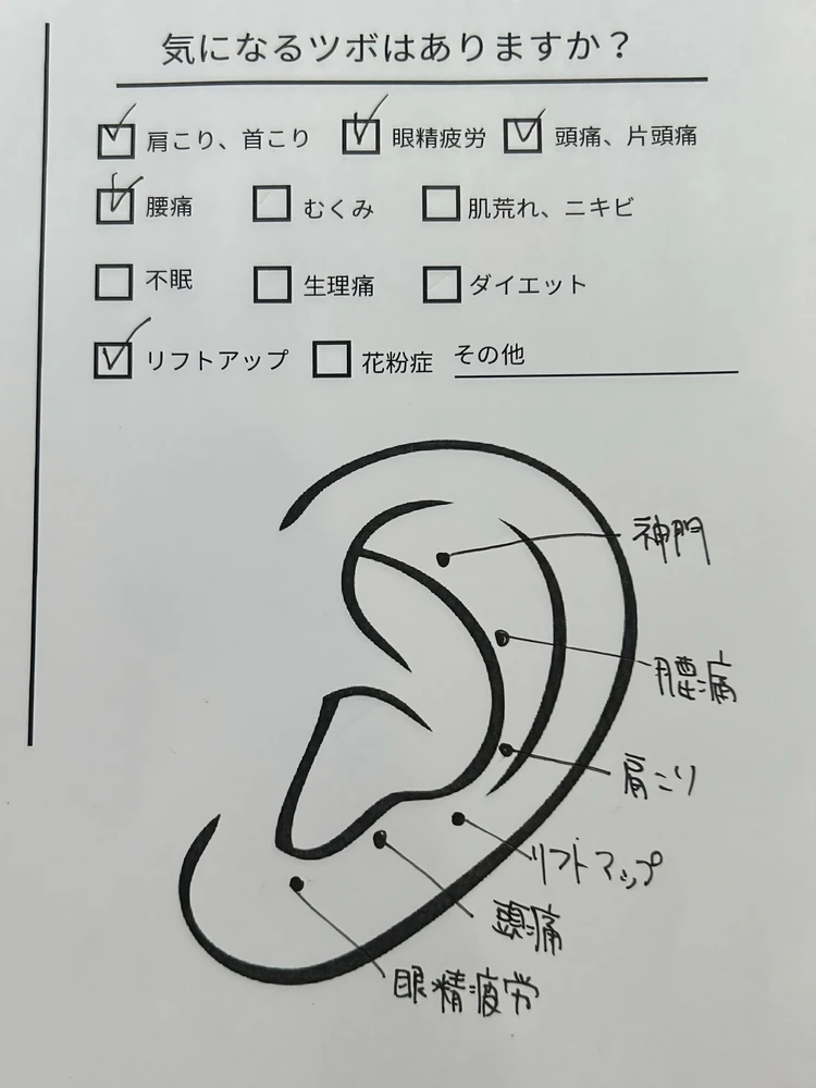 話題沸騰中の【耳つぼジュエリー】施術と効果を徹底解説！_1