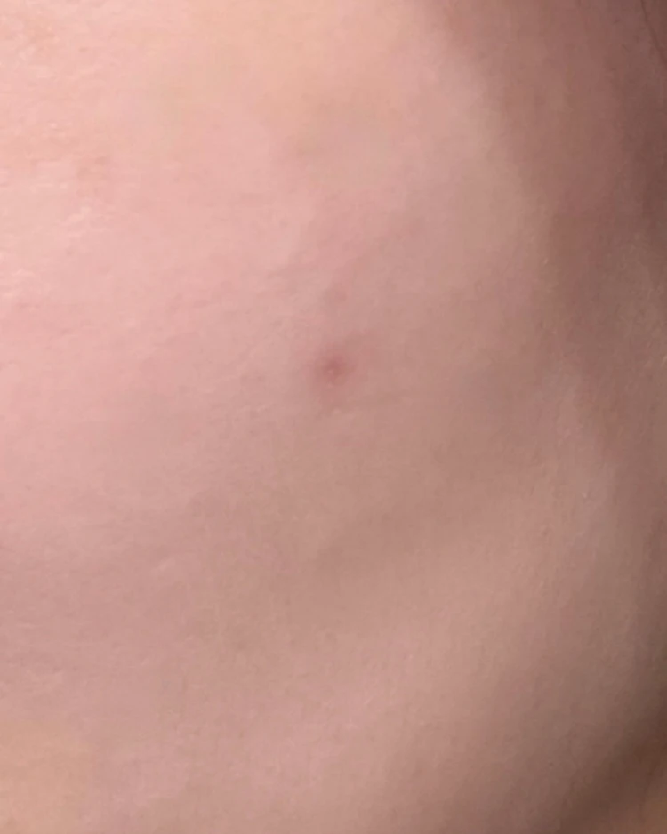 【2025年ベスト美容医療】美容オタクOLが選ぶ「アドバテックスレーザー」が“推せる”理由_8_1