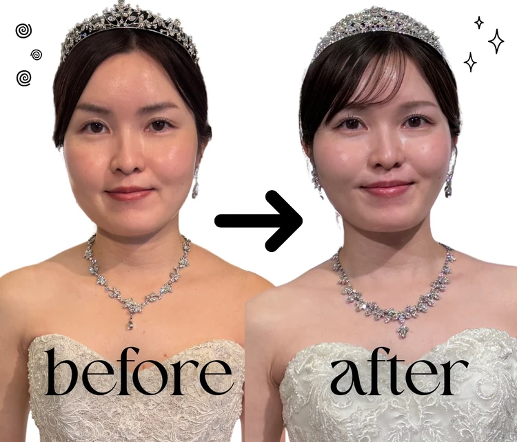 【無加工】3ヶ月で劇的垢抜け!プレ花嫁がやった5つのこと_2