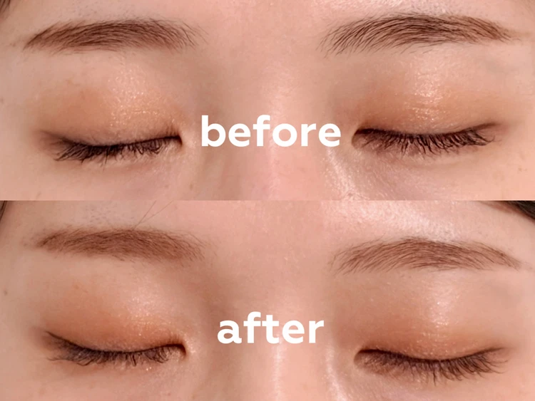 黒い眉毛から茶色くなった眉のアップ画像