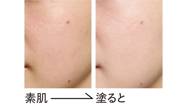 PERFECT ONEのビフォーアフター画像