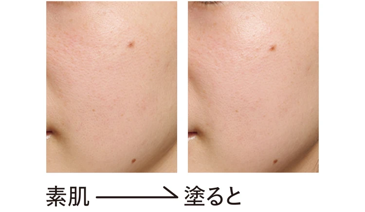 ALBIONのビフォーアフター画像