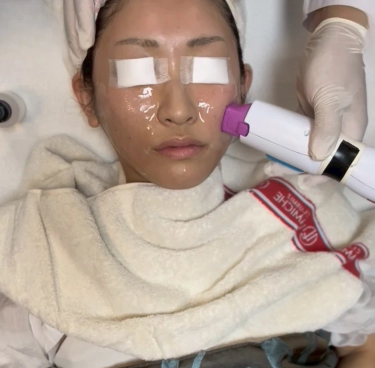 韓国美容旅レポ｜ラミチェクリニックで10施術体験記_9