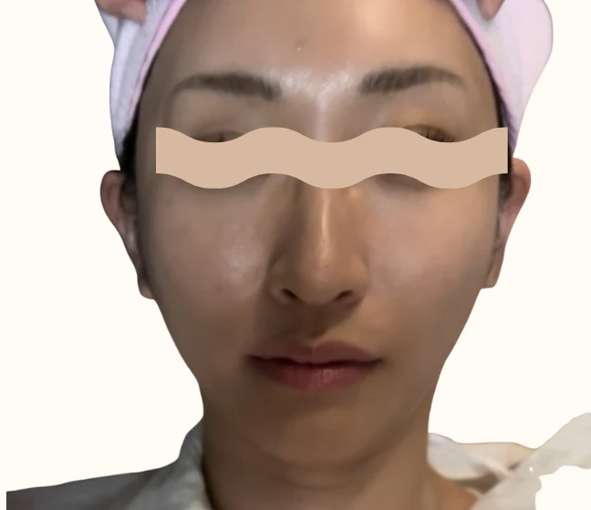 韓国美容旅レポ｜ラミチェクリニックで10施術体験記_7