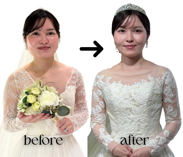 【無加工】3ヶ月で劇的垢抜け!プレ花嫁がやった5つのこと_10