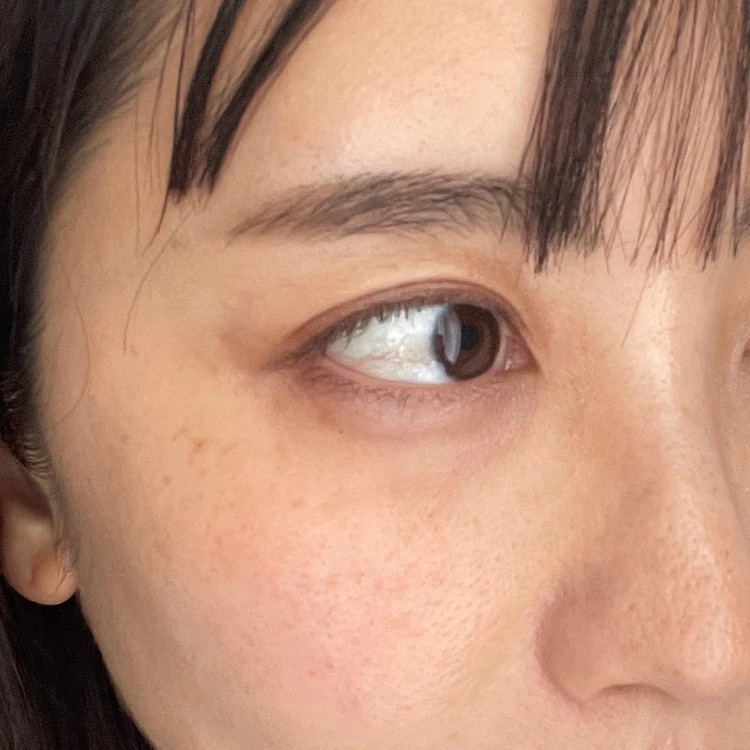 点眼前の濁った瞳