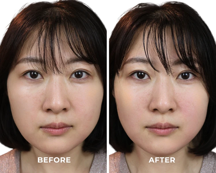 【SALONIA】一本3役!筋膜直アプローチのペン型美顔器を徹底レビュー【新発売】_4