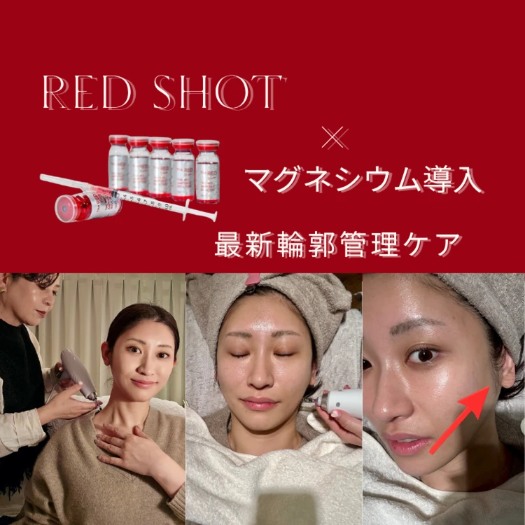 スーパーバイラーズ 美容部の愛用スキンケア＆コスメ紹介　フォトギャラリー_0