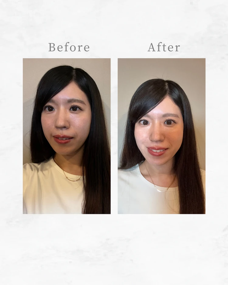 【ETVOS】乾燥肌のクマ悩みに!捨て色なし3色コンシーラーが優秀すぎた_3