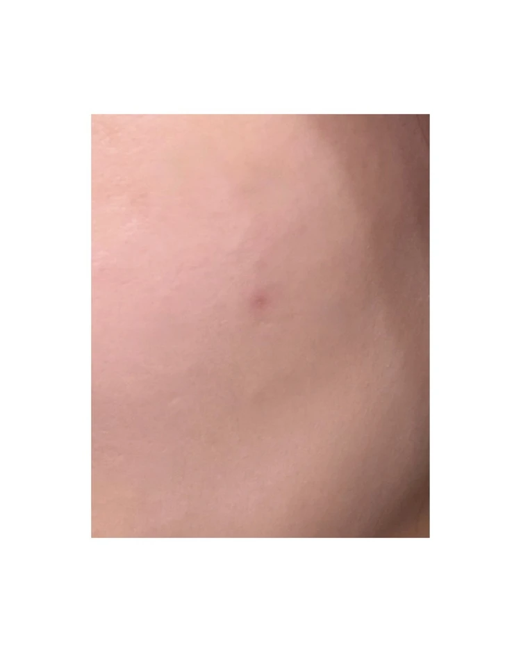 【2025年ベスト美容医療】美容オタクOLが選ぶ「アドバテックスレーザー」が“推せる”理由_4