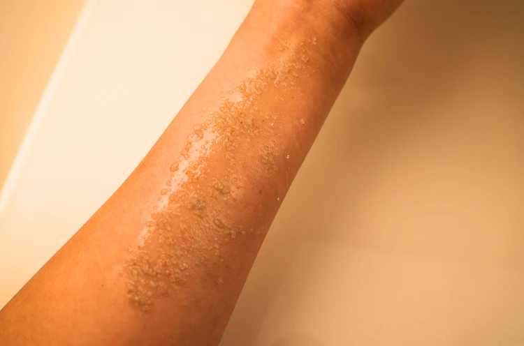 【日本上陸】ポーランド発ナチュラルコスメ!4Starlingsで秋へ角質ケア【ヨーロッパ人気】_5