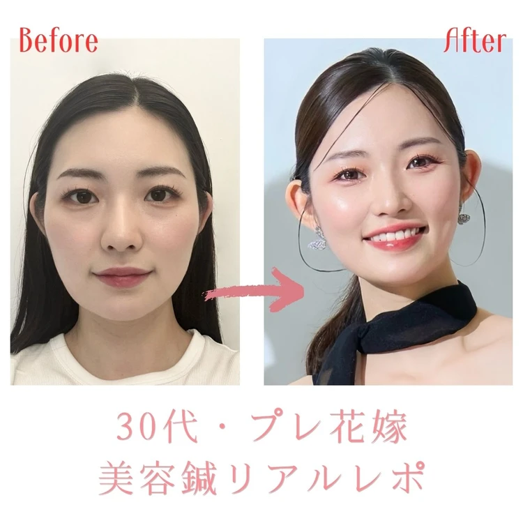 【一覧】みんなが使っているツヤ肌コスメ＆テク_0