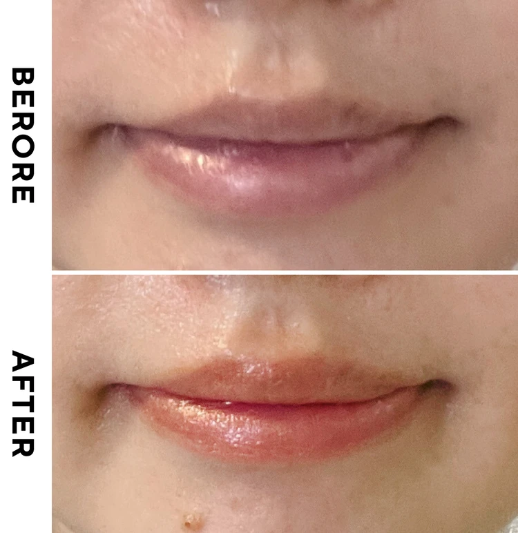 ビフォーアフター画像