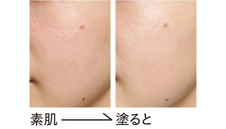 ALLIEのビフォーアフター画像