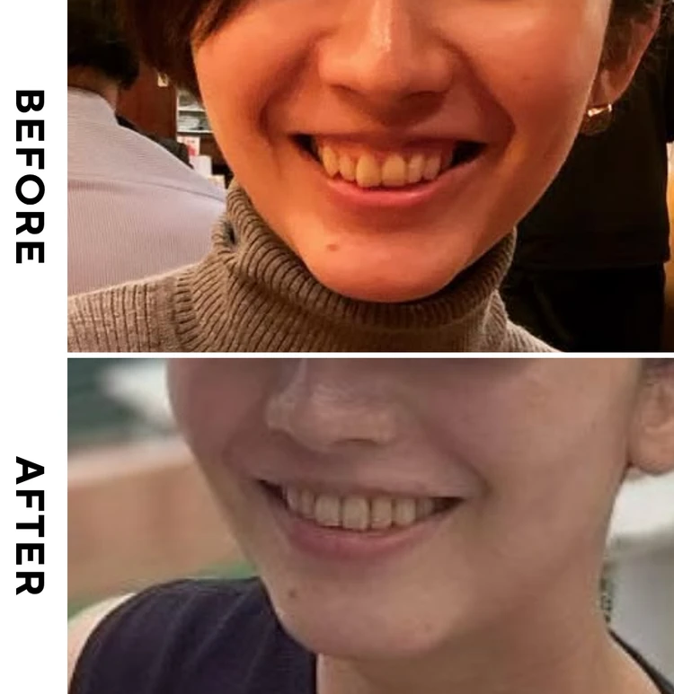 ビフォーアフター