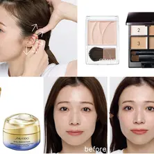 【今あるクマについて本気で考える〈まとめ〉】セルフケアから手術まで、レベル別に一挙紹介!