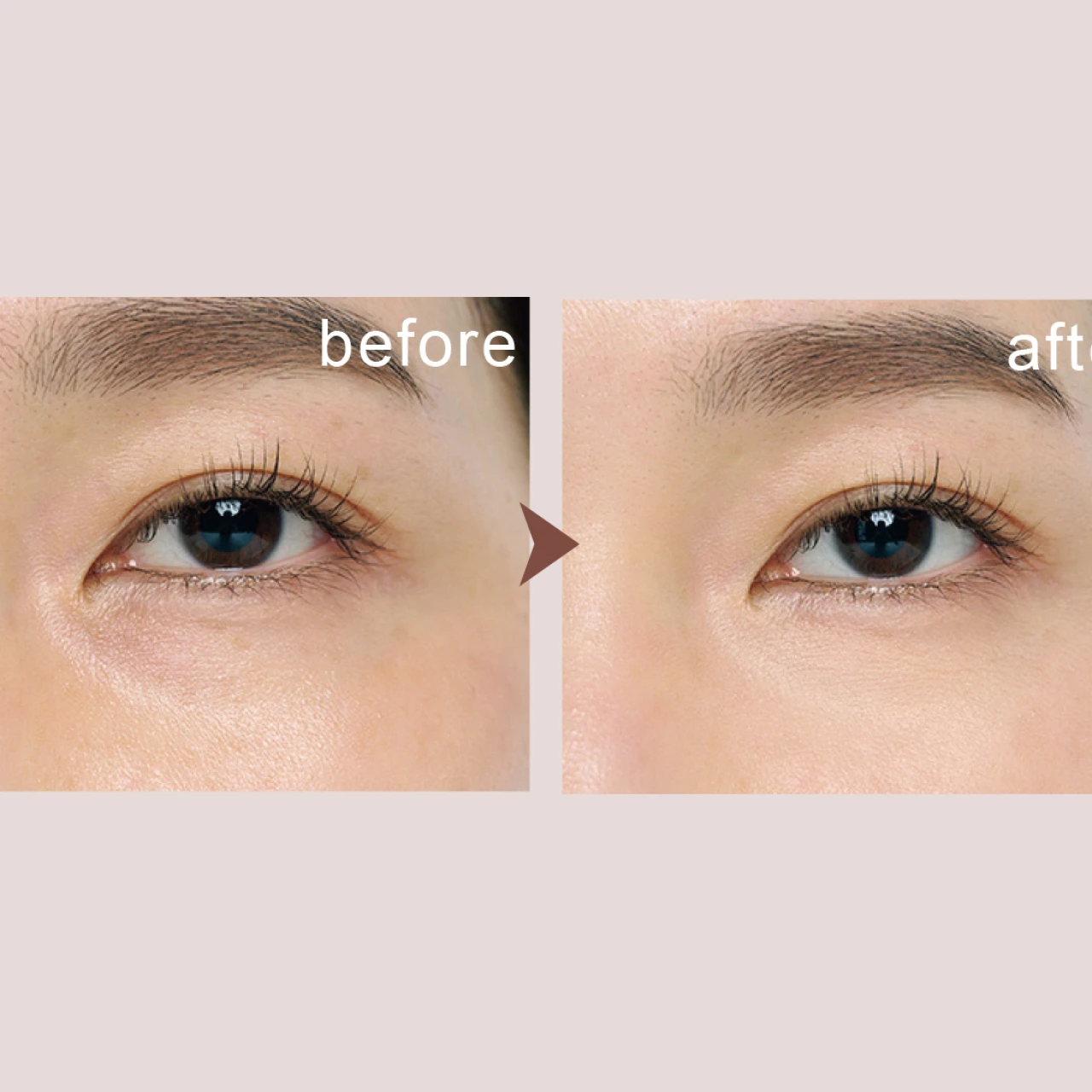 目の下のクマをカバーする“正しいメイク方法”とは?コンシーラーとハイライトで自然に仕上げるコツを伝授!