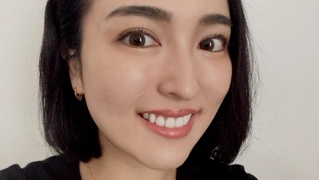 【アラサー美容】歯列矯正を終えた私が、次にしたのは「歯のホワイトニング」
