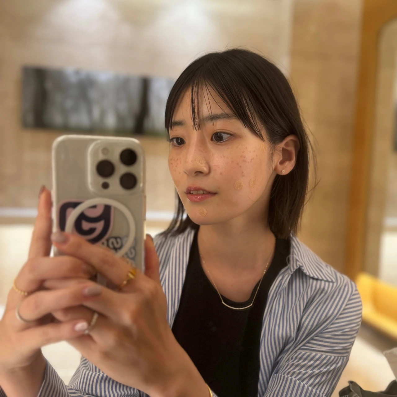 【韓国でシミ取り】本当は教えたくないソウルの皮膚科クリニック