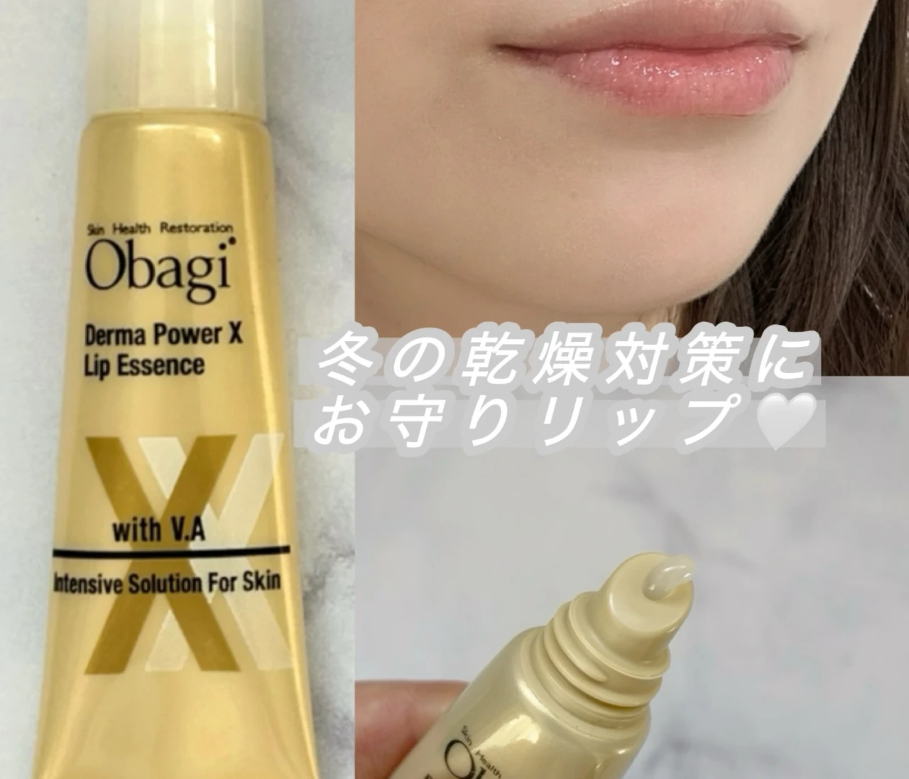 【バイラーズ乾燥対策Q&A】冬の唇の乾燥・荒れを徹底ケア。 Obagi（オバジ）リップエッセンスは私のお守りリップ