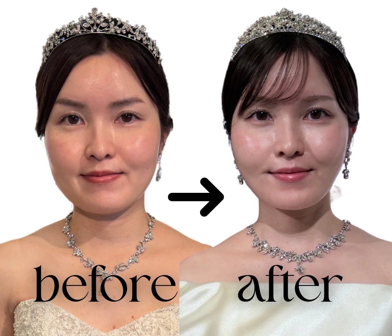 【無加工】3ヶ月で劇的垢抜け！プレ花嫁がやった5つのこと