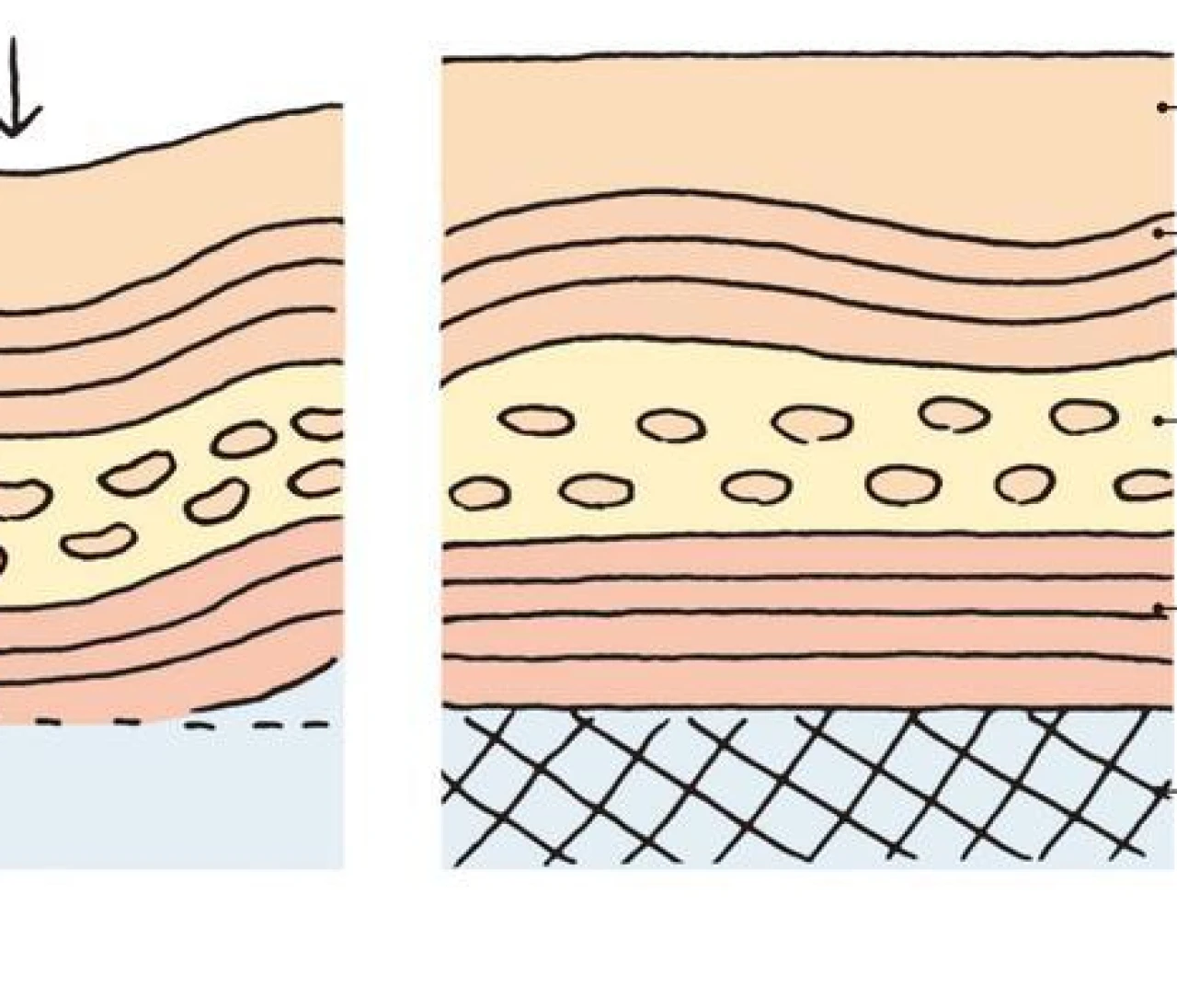 たるみ顔に効かせるスキンケア＆マッサージ＆美容医療（写真）