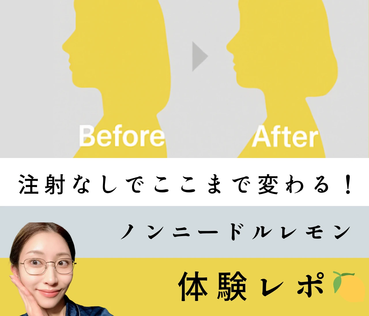 【体験レポ】注射なしで顔も腕もスッキリ！エステで受けるノンニードルレモンボトルが予想以上だった