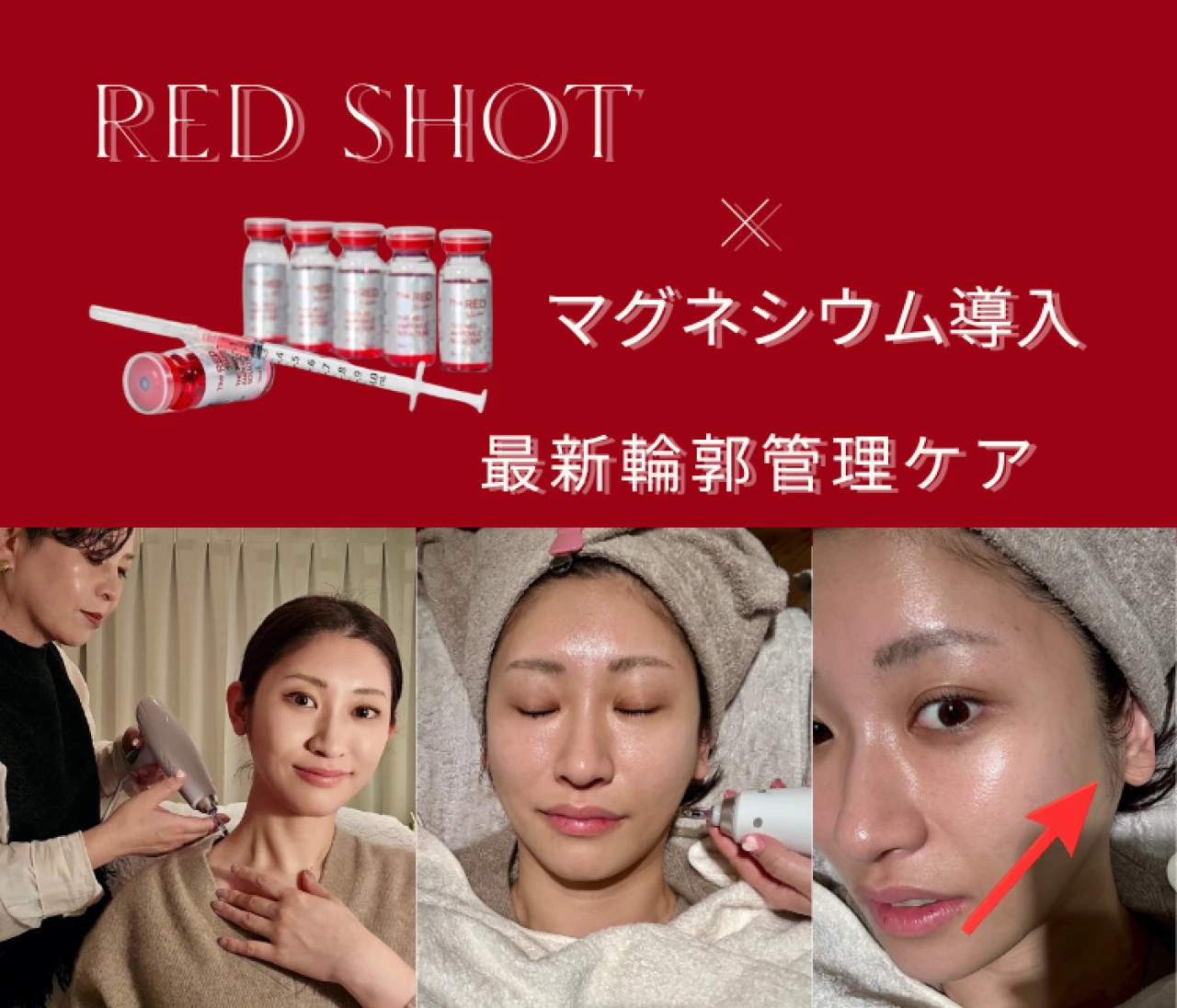 日本ではまだ珍しいのに、効果は桁違い。 最新の輪郭管理ケアを受けてきました