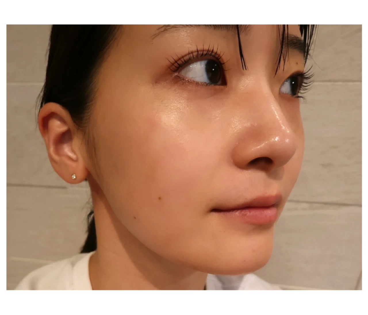 【韓国で肌管理】リジュランHBプラス 本音レビュー！