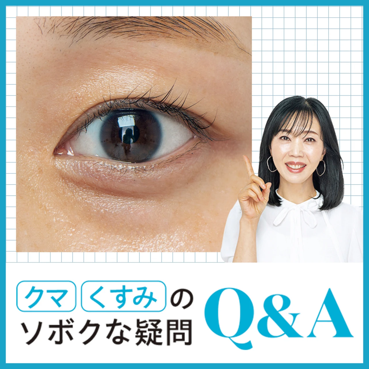 クマができてしまう原因は?30代でクマ取り手術してもOK?トータルビューティアドバイザー水井真理子さんがアンサー!