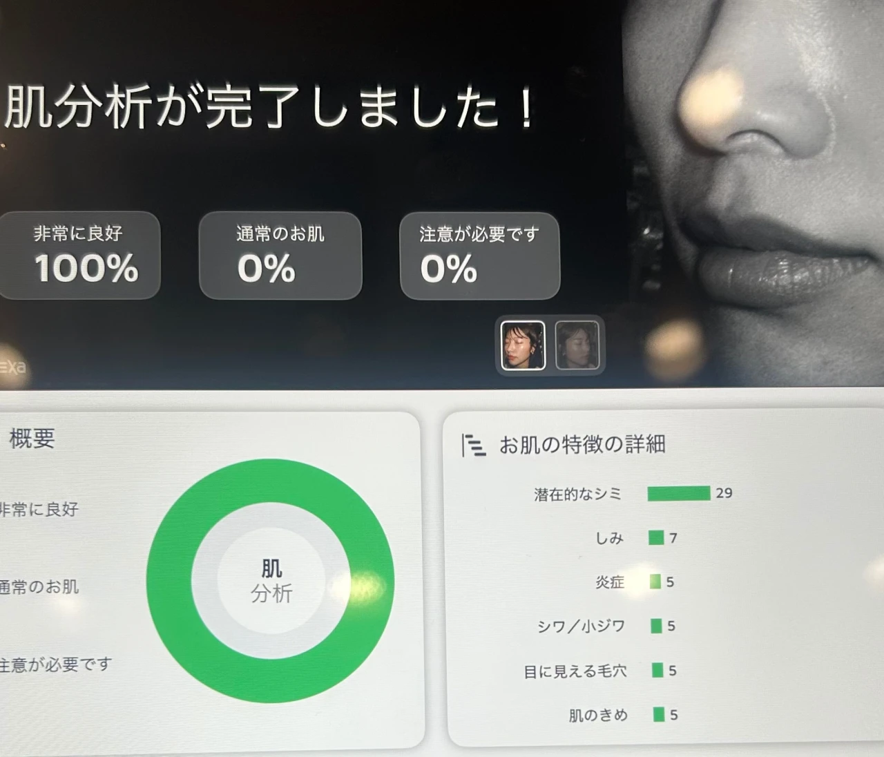 【実録】肌診断で驚異の「100%」を記録！乾燥肌の私が行き着いた、朝晩のリアルなスキンケア