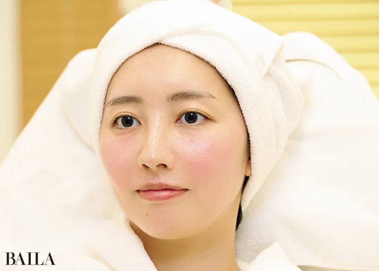 個人差はあるが山田さんは内出血もほぼ出ず終了。