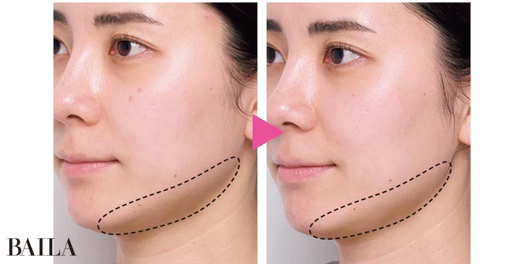 「顔全体にハリ感が誕生♡　輪郭のもたつきも感じなくなりました！」山田里紗さん