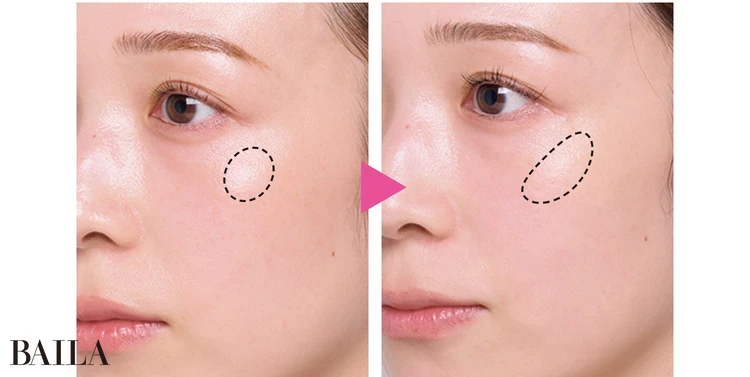 「疲れると頰がこける現象がなくなりました。ほうれい線も薄めに。」土佐李穂さん