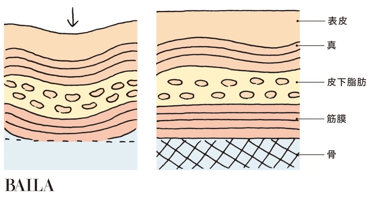 たるみは骨・筋膜・皮膚すべての衰えが原因！