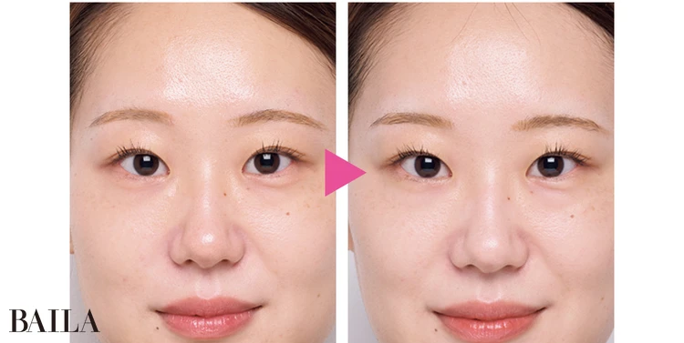 「使い始めて1週間ぐらいで、目の下やおでこにハリを感じるように。」三間理沙さん